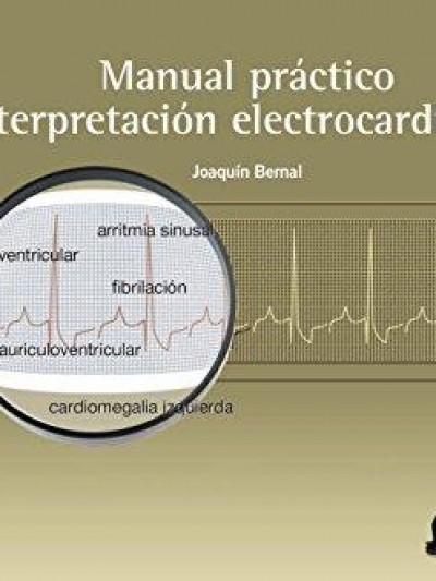 Libro: Manual Práctico de Interpretación Electrocardiográfica