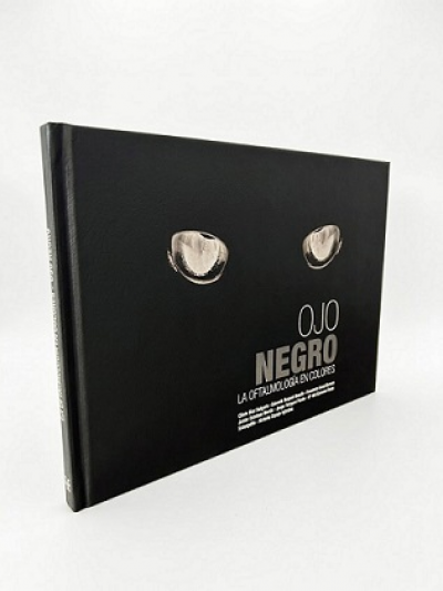 Libro: Ojo Negro. La Oftalmología en Colores